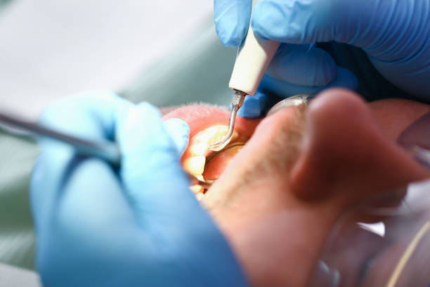 Best Dentist for Tooth Abscess  in South Patrick Shores, FL