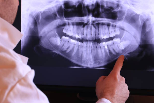 Best Tooth Pain Emergency Relief  in South Patrick Shores, FL
