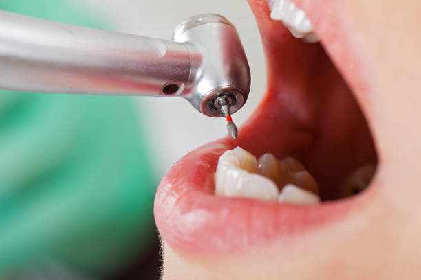 Best Urgent Tooth Repair  in South Patrick Shores, FL
